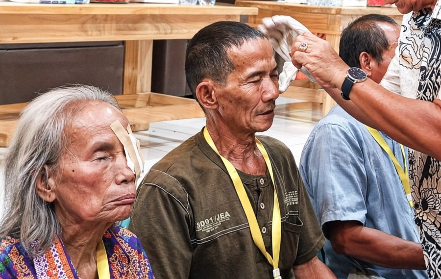 Pasien melakukan pelepasan perban operasi katarak massal di RSUD HIS (Adi/Korankaltim.com)