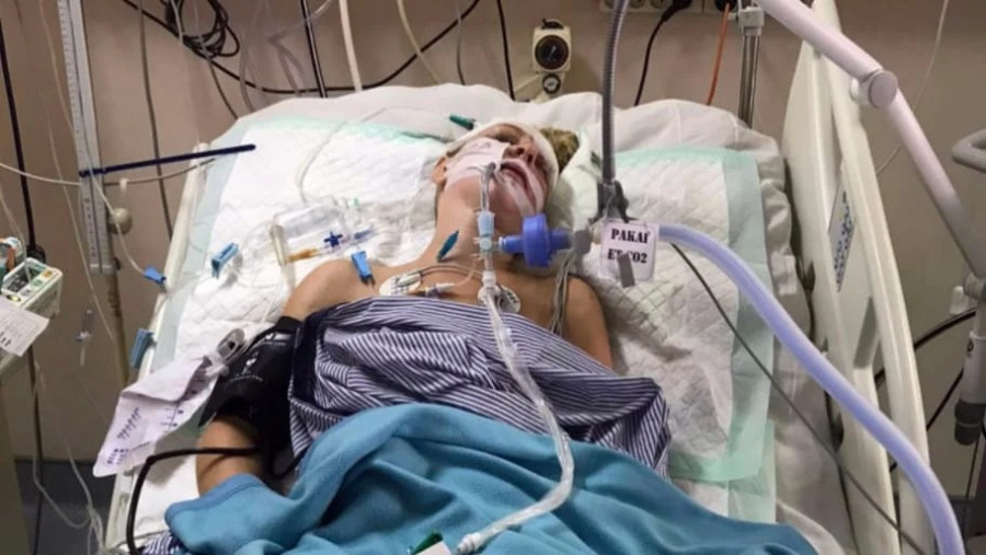 Kondisi Kaitlyn McCaffery yang koma selama dua bulan setelah mengalami kecelakaan motor di Bali. (Foto: www.thedailybeast.com)